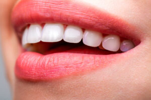 Beautiful young woman teeth. Teeth whitening. Dental health concept. Teeth whitening procedure. Dental care.